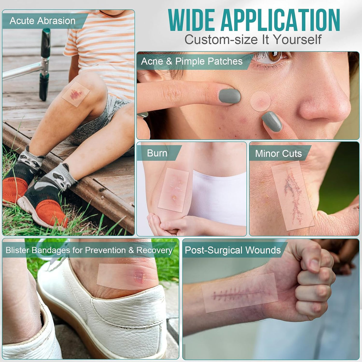 Hydrocolloid Roll – Multi-Purpose Skin Patch for Pimples.Acne, Blemishes, Scars & Blister Care by Havvibe